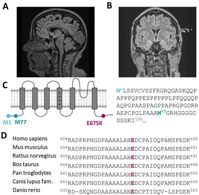 A novel KCNC3 gene variant in the voltage-dependent Kv3.3 channel in an atypical form of SCA13 with dominant central vertigo